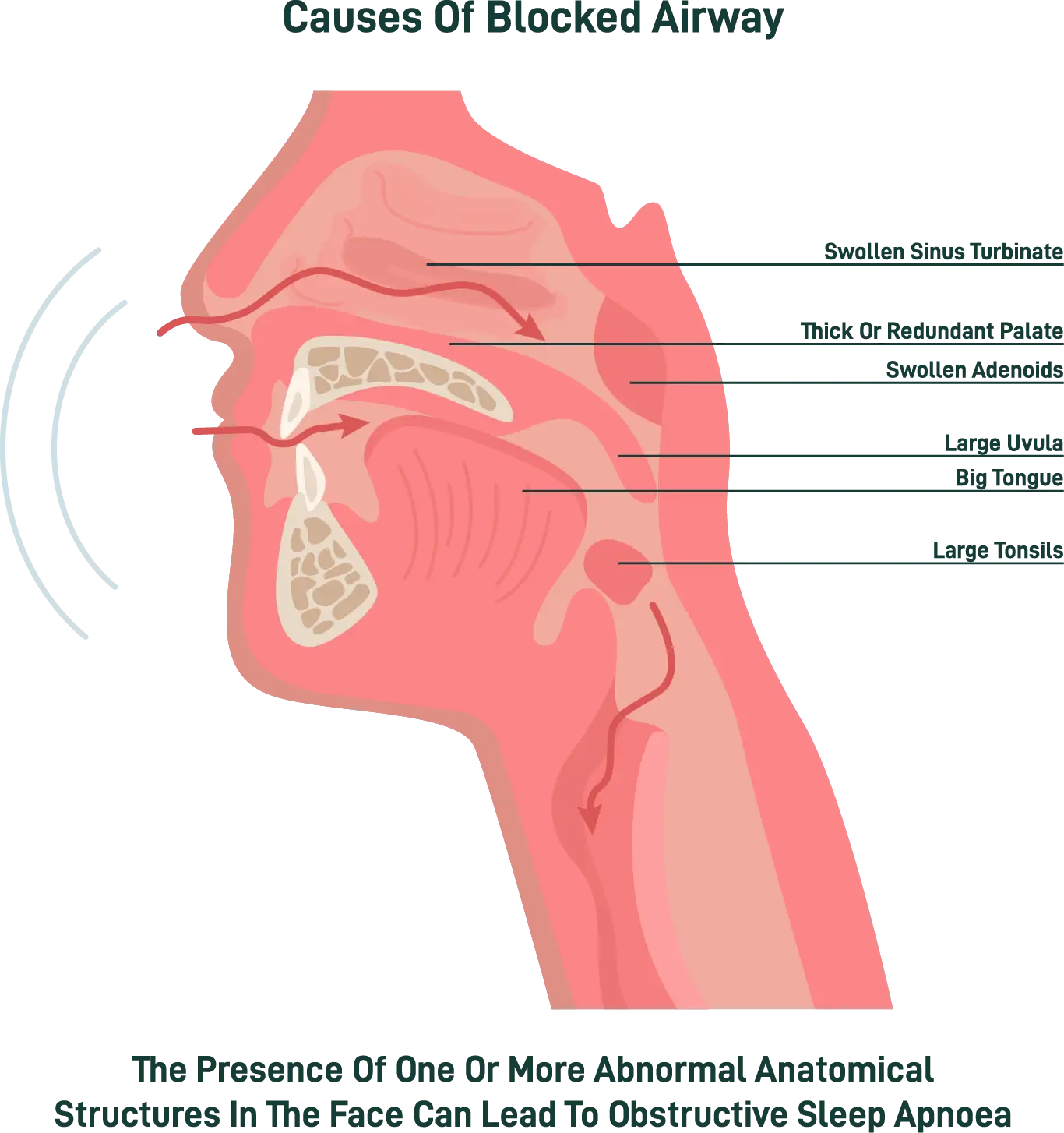 Difficulty Breathing treatment at the TMJ & Sleep Therapy Centre of New Orleans Difficulty Breathing treatment at the TMJ & Sleep Therapy Centre of New Orleans