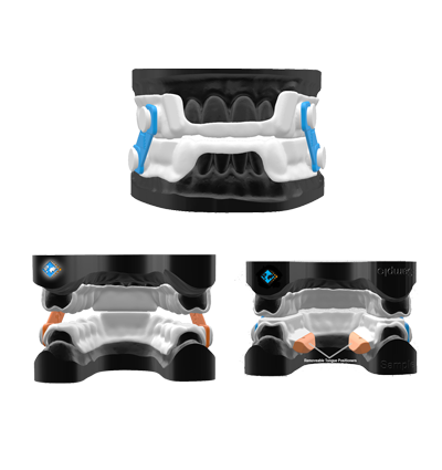 Expert Sleep Appliances at the TMJ & Sleep Therapy Centre of New Orleans Expert Sleep Appliances at the TMJ & Sleep Therapy Centre of New Orleans