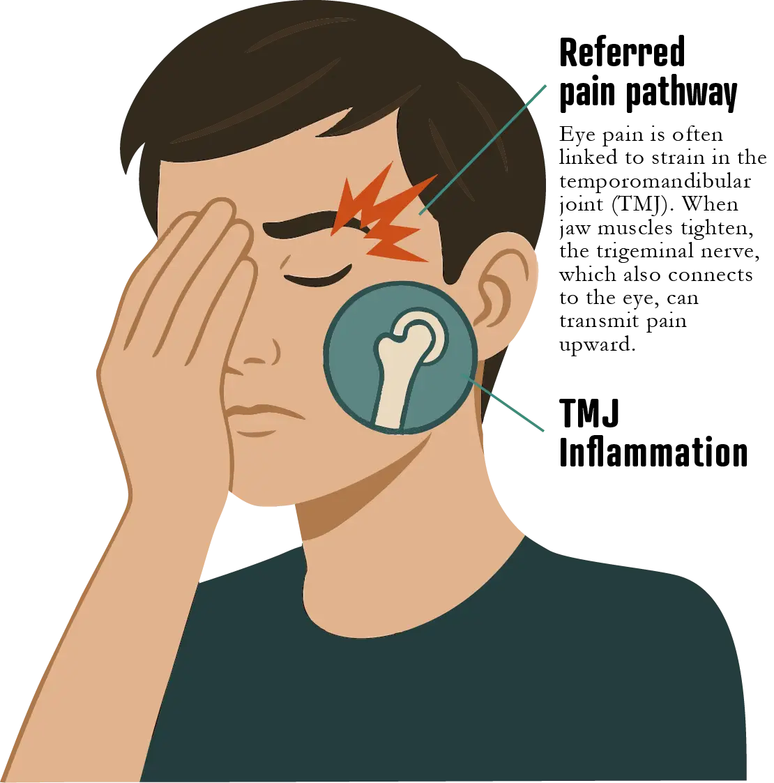 Eye Pain treatment at the TMJ & Sleep Therapy Centre of New Orleans Eye Pain treatment at the TMJ & Sleep Therapy Centre of New Orleans