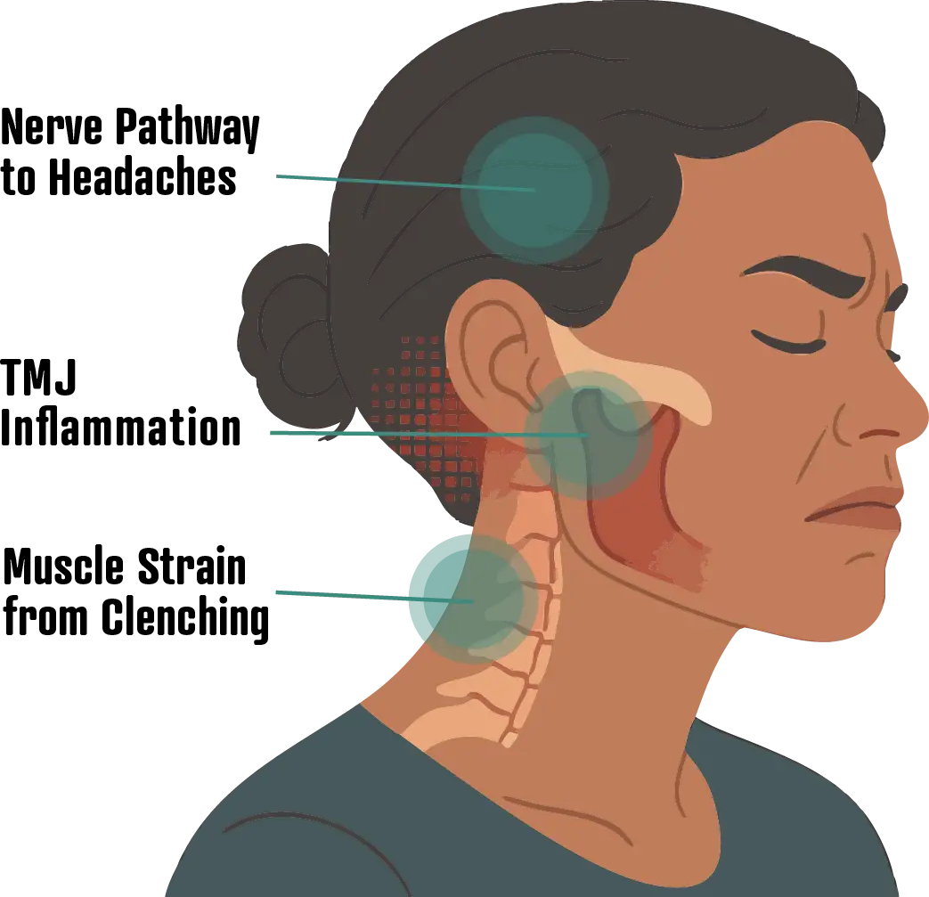 Jaw Clenching treatment at the TMJ & Sleep Therapy Centre of New Orleans Jaw Clenching treatment at the TMJ & Sleep Therapy Centre of New Orleans