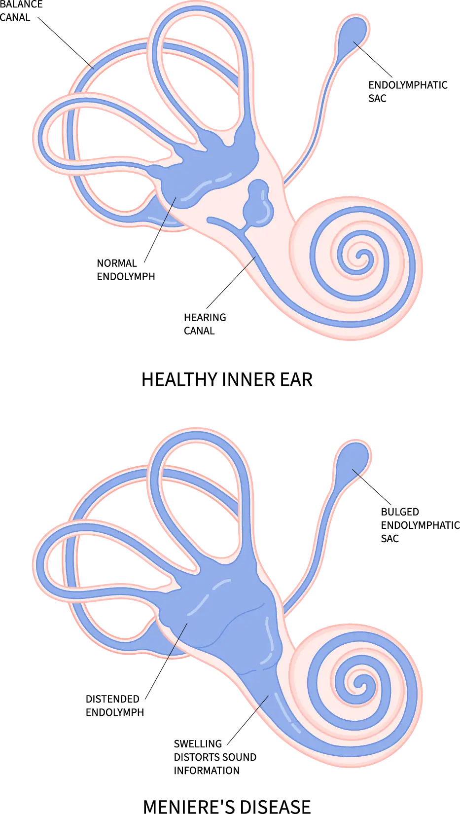 Meniere’s Disease treatment at the TMJ & Sleep Therapy Centre of New Orleans Meniere’s Disease treatment at the TMJ & Sleep Therapy Centre of New Orleans