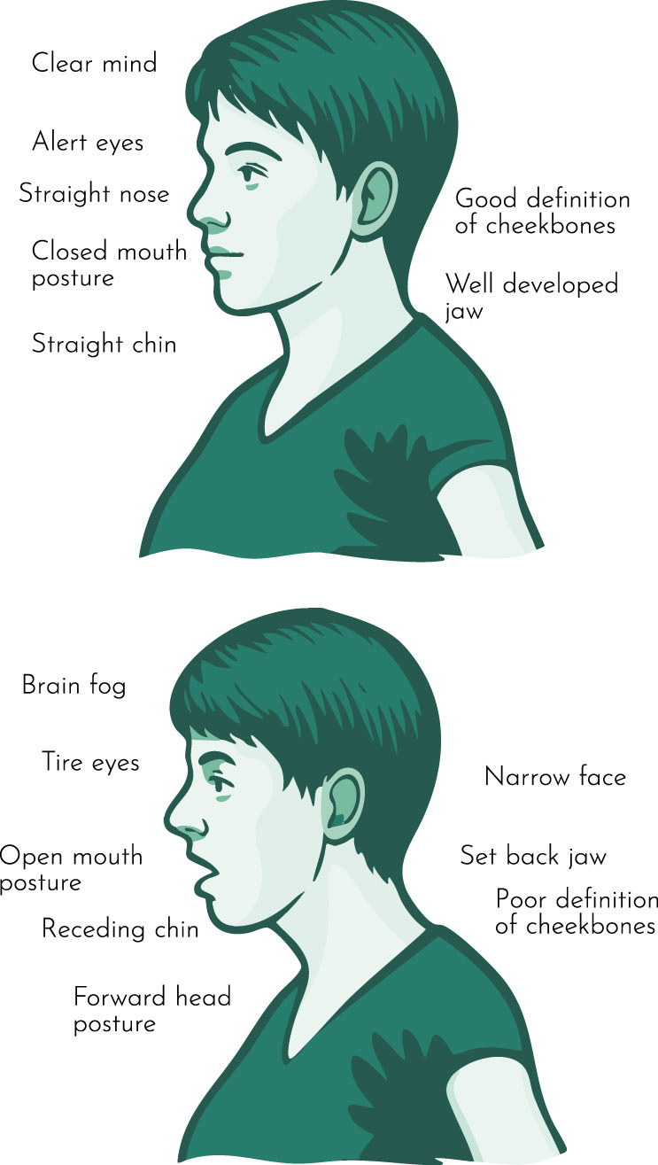 Expert Myofunctional Therapy at the TMJ & Sleep Therapy Centre of New Orleans Expert Myofunctional Therapy at the TMJ & Sleep Therapy Centre of New Orleans