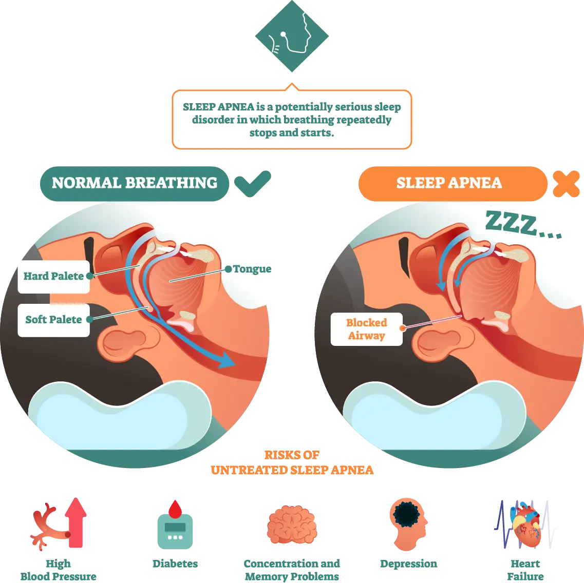 Understanding Sleep Apnea at the TMJ & Sleep Therapy Centre of New Orleans Understanding Sleep Apnea at the TMJ & Sleep Therapy Centre of New Orleans