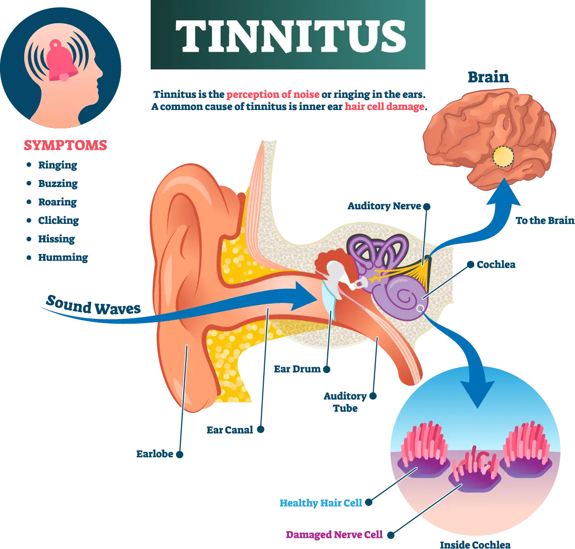 Tinnitus treatment at the TMJ & Sleep Therapy Centre of New Orleans Tinnitus treatment at the TMJ & Sleep Therapy Centre of New Orleans