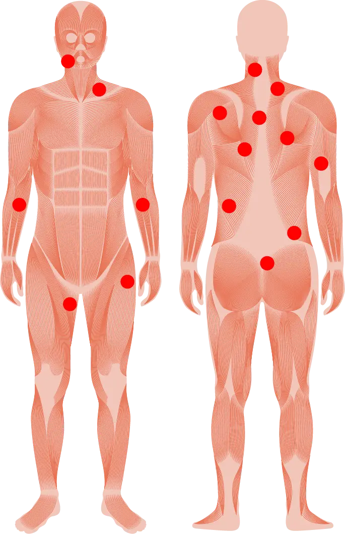 Expert Trigger Point Therapy at the TMJ & Sleep Therapy Centre of New Orleans Expert Trigger Point Therapy at the TMJ & Sleep Therapy Centre of New Orleans