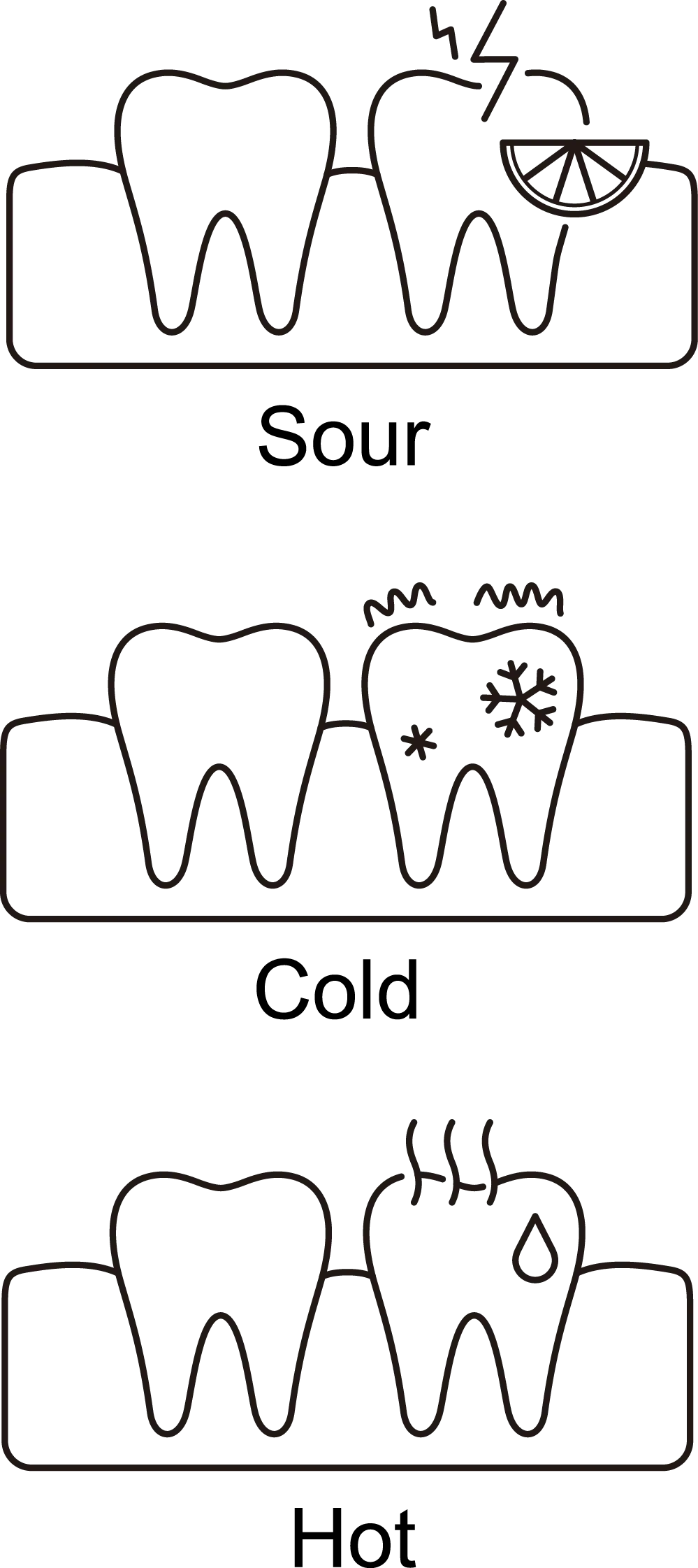 Teeth Sensitivity treatment at the TMJ & Sleep Therapy Centre of New Orleans Teeth Sensitivity treatment at the TMJ & Sleep Therapy Centre of New Orleans
